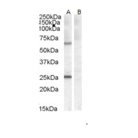 Western Blot - Anti-CERT Antibody (A83332) - Antibodies.com