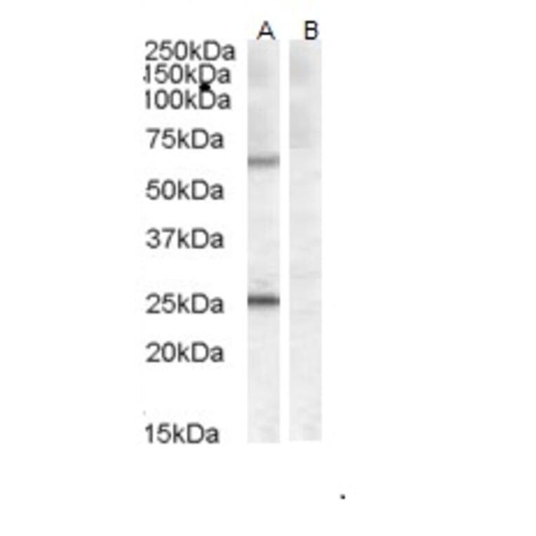 Western Blot - Anti-CERT Antibody (A83332) - Antibodies.com