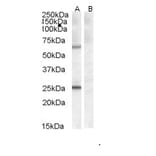 Western Blot - Anti-CERT Antibody (A83332) - Antibodies.com
