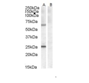 Western Blot - Anti-COL4A3BP Antibody (A83332)