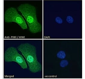 Immunofluorescence - Anti-PIWIL1 Antibody (A83335) - Antibodies.com