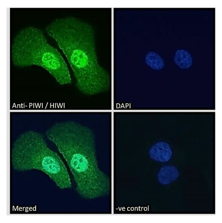 Immunofluorescence - Anti-PIWIL1 Antibody (A83335) - Antibodies.com