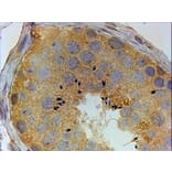 Immunohistochemistry - Anti-PIWIL1 Antibody (A83335) - Antibodies.com