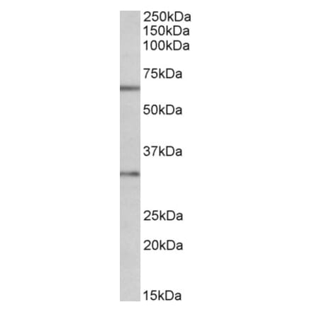 Western Blot - Anti-Caspase-3 Antibody (A83337) - Antibodies.com