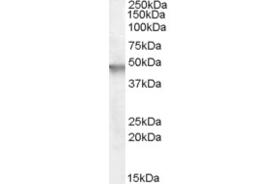 Western Blot - Anti-Cytohesin 2 Antibody (A83338) - Antibodies.com