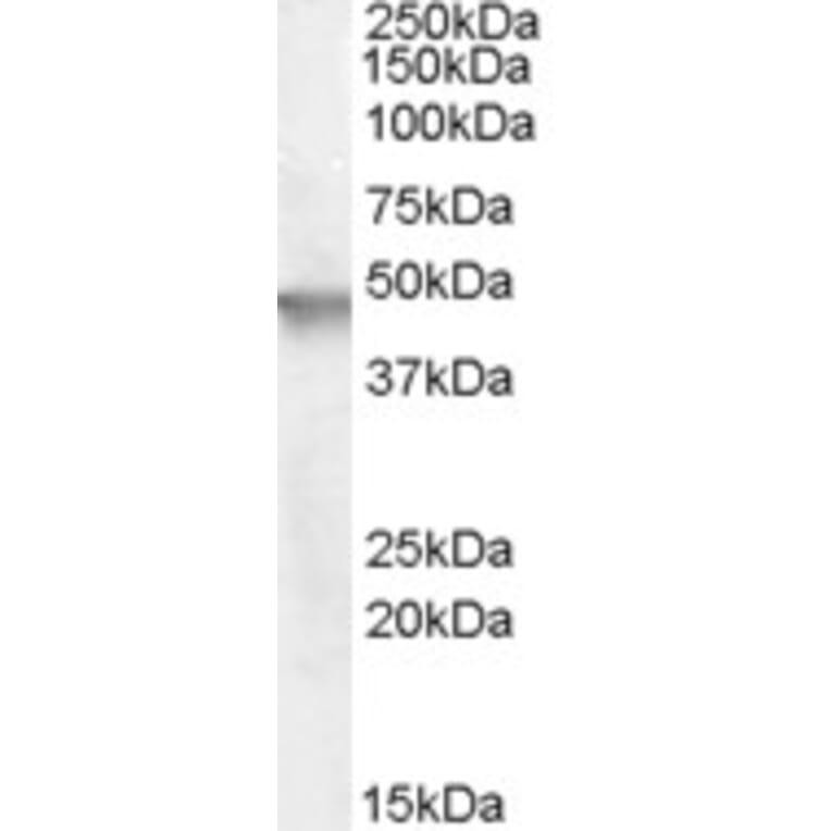 Western Blot - Anti-Cytohesin 2 Antibody (A83338) - Antibodies.com
