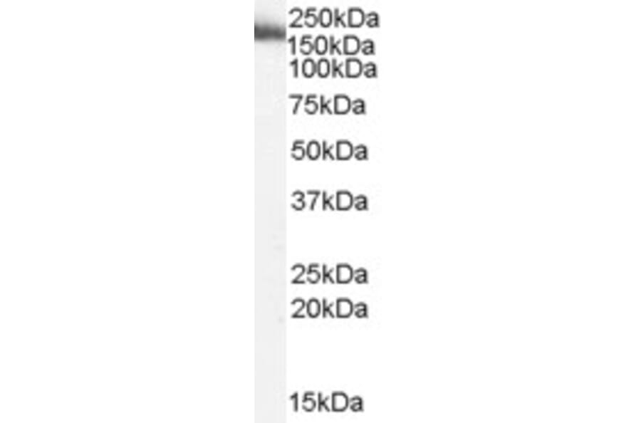 Western Blot - Anti-MYO9B Antibody (A83339) - Antibodies.com