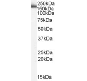 Western Blot - Anti-MYO9B Antibody (A83339) - Antibodies.com