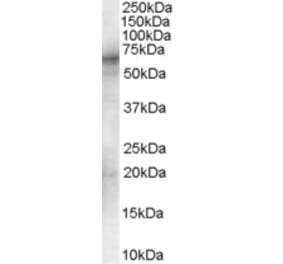 Western Blot - Anti-Syk Antibody (A83340) - Antibodies.com