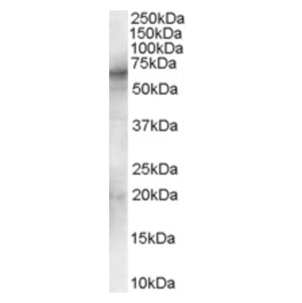 Western Blot - Anti-Syk Antibody (A83340) - Antibodies.com