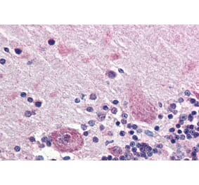 Immunohistochemistry - Anti-PPP2R3A Antibody (A83341) - Antibodies.com