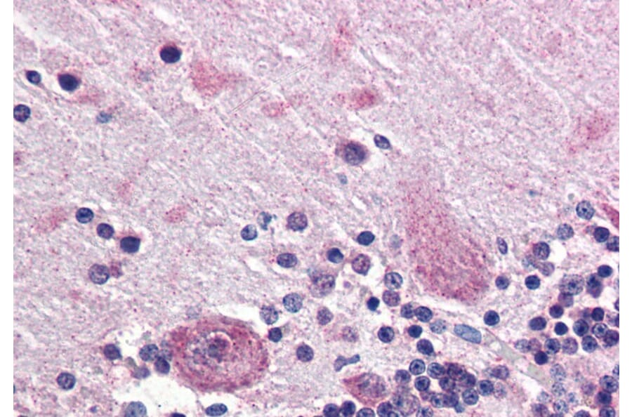 Immunohistochemistry - Anti-PPP2R3A Antibody (A83341) - Antibodies.com