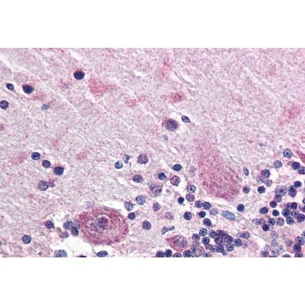 Immunohistochemistry - Anti-PPP2R3A Antibody (A83341) - Antibodies.com