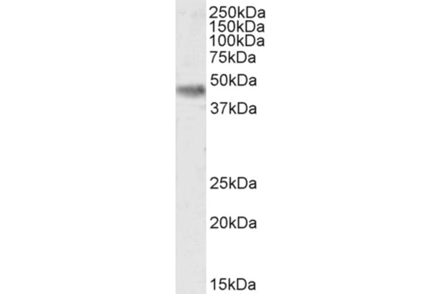 Western Blot - Anti-Casein Kinase 1 delta/CSNK1D Antibody (A83343) - Antibodies.com