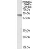 Western Blot - Anti-Casein Kinase 1 delta/CSNK1D Antibody (A83343) - Antibodies.com
