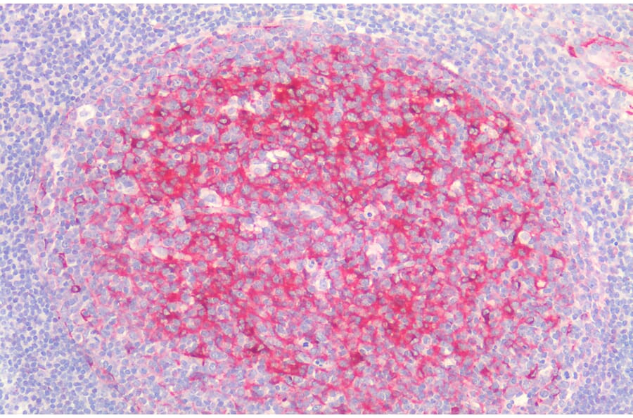 Immunohistochemistry - Anti-Clusterin Antibody (A83344) - Antibodies.com