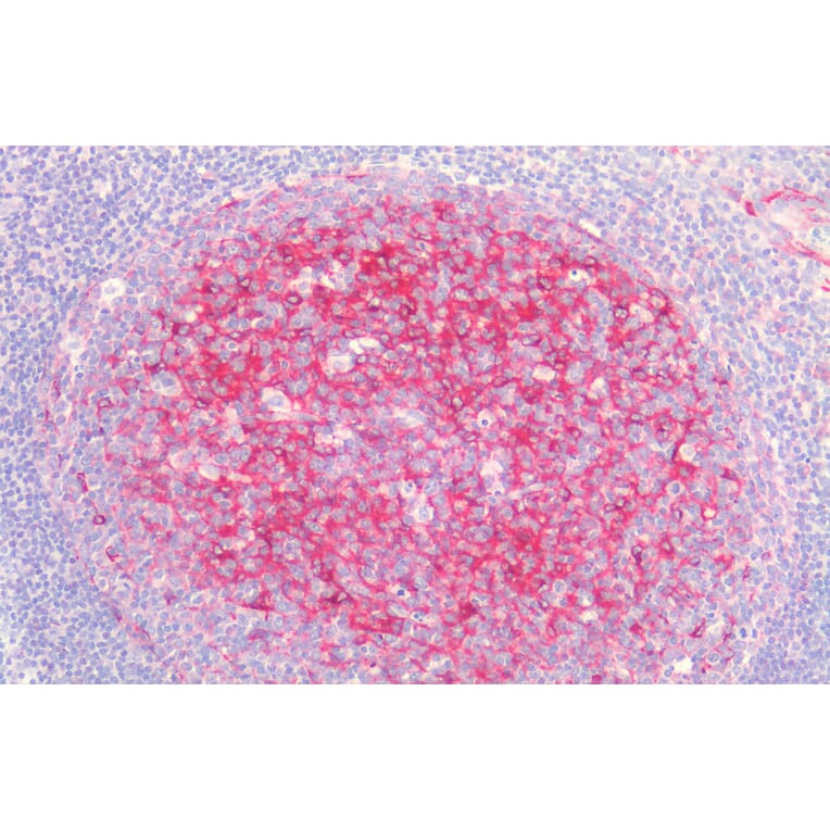 Immunohistochemistry - Anti-Clusterin Antibody (A83344) - Antibodies.com