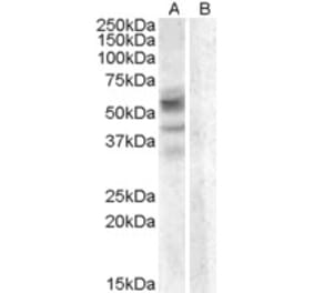 Western Blot - Anti-Arylsulfatase D Antibody (A83345) - Antibodies.com