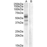 Western Blot - Anti-Arylsulfatase D Antibody (A83345) - Antibodies.com