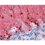 Immunohistochemistry - Anti-Amphiphysin Antibody (A83346) - Antibodies.com