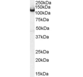Western Blot - Anti-AMPH Antibody (A83346) - Antibodies.com
