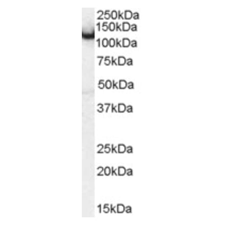 Western Blot - Anti-AMPH Antibody (A83346) - Antibodies.com