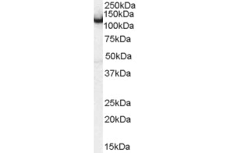Western Blot - Anti-Amphiphysin Antibody (A83346) - Antibodies.com
