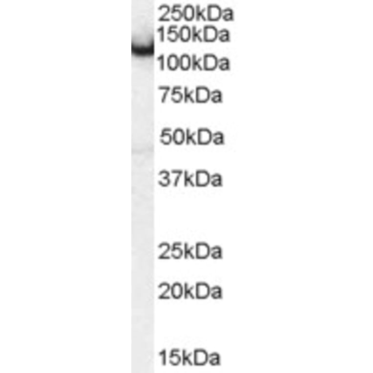 Western Blot - Anti-Amphiphysin Antibody (A83346) - Antibodies.com