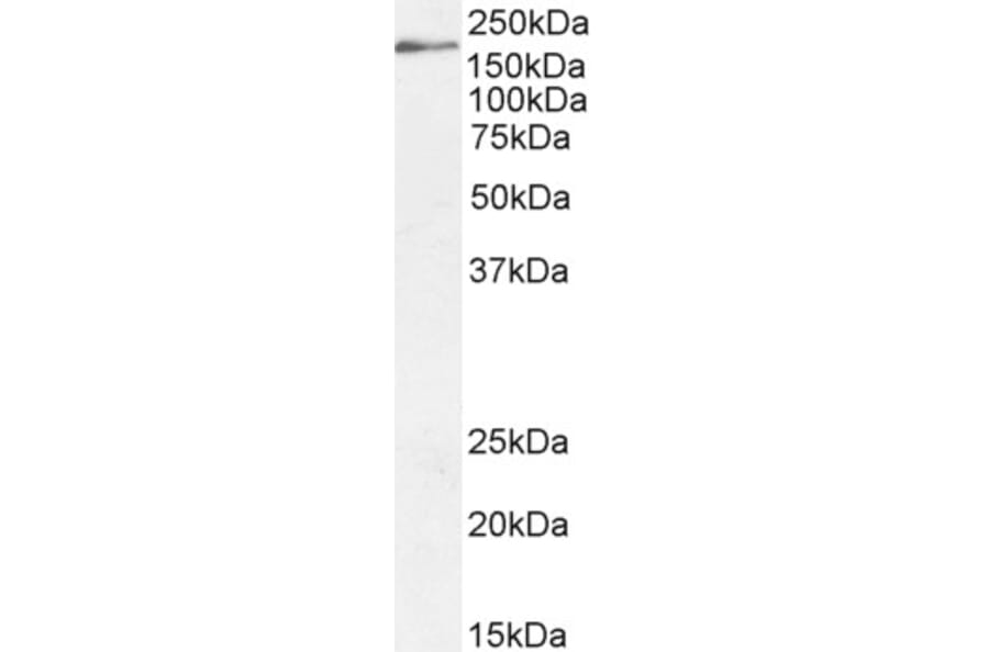 Western Blot - Anti-Dscam Antibody (A83347) - Antibodies.com