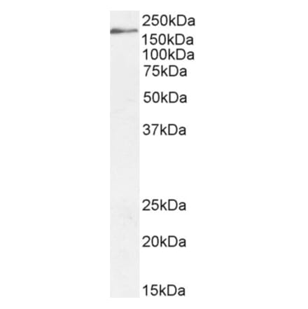 Western Blot - Anti-Dscam Antibody (A83347) - Antibodies.com