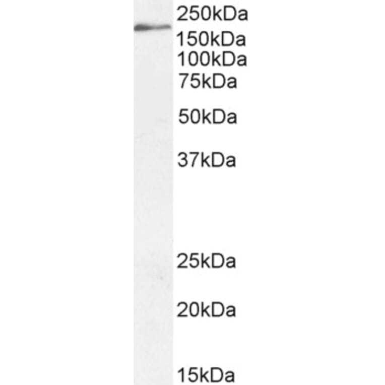 Western Blot - Anti-Dscam Antibody (A83347) - Antibodies.com