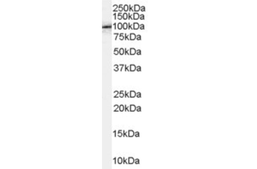Western Blot - Anti-FE65 Antibody (A83348) - Antibodies.com