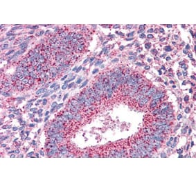 Immunohistochemistry - Anti-PTPRM Antibody (A83349) - Antibodies.com