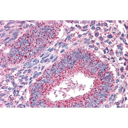 Immunohistochemistry - Anti-PTPRM Antibody (A83349) - Antibodies.com