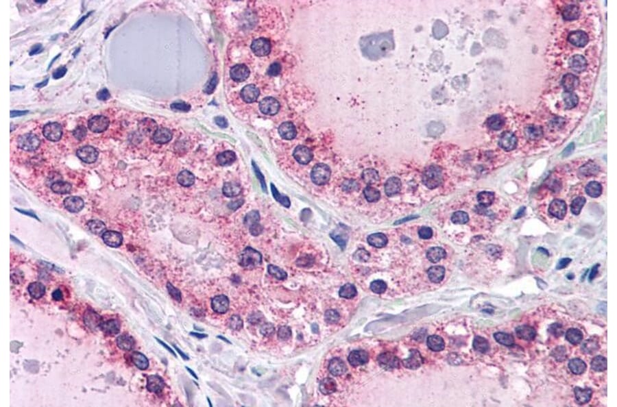 Immunohistochemistry - Anti-PTPRM Antibody (A83349) - Antibodies.com