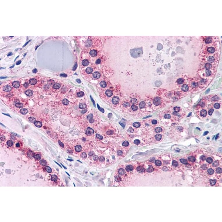 Immunohistochemistry - Anti-PTPRM Antibody (A83349) - Antibodies.com