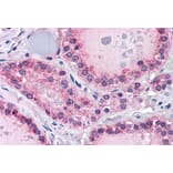 Immunohistochemistry - Anti-PTPRM Antibody (A83349) - Antibodies.com