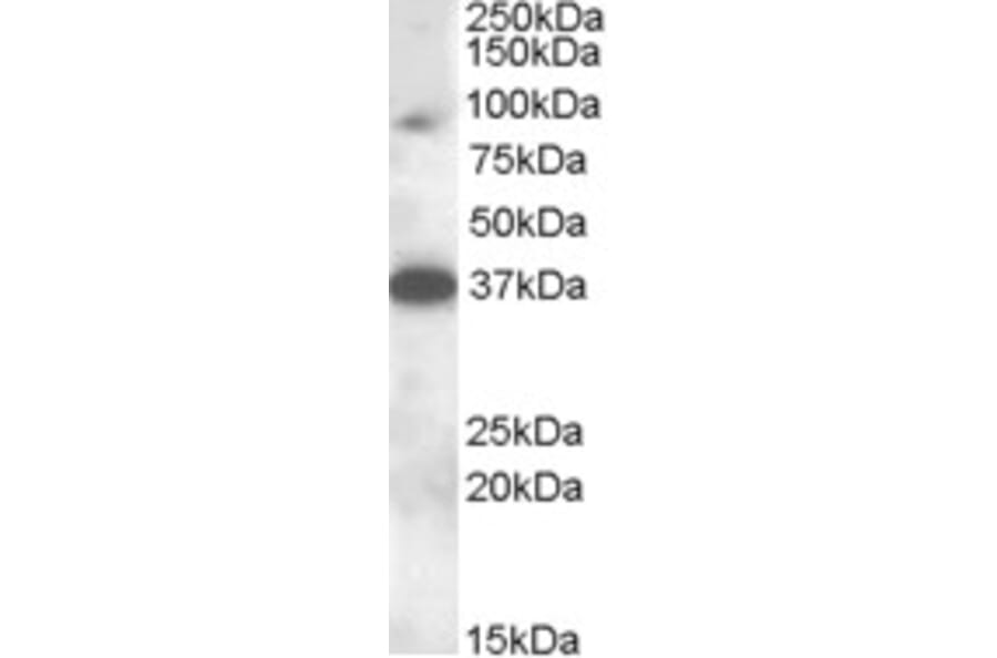 Western Blot - Anti-MARCH10 Antibody (A83350) - Antibodies.com