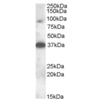 Western Blot - Anti-MARCH10 Antibody (A83350) - Antibodies.com