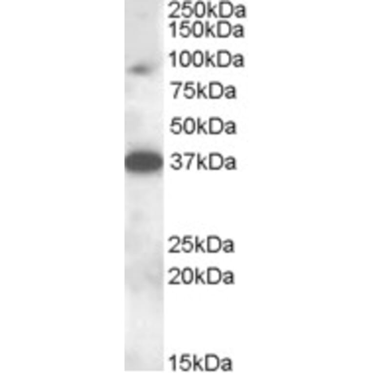 Western Blot - Anti-MARCH10 Antibody (A83350) - Antibodies.com