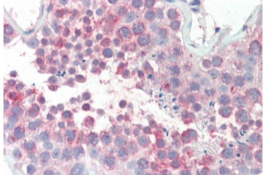 Immunohistochemistry - Anti-MARCH10 Antibody (A83350) - Antibodies.com