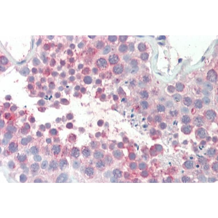 Immunohistochemistry - Anti-MARCH10 Antibody (A83350) - Antibodies.com