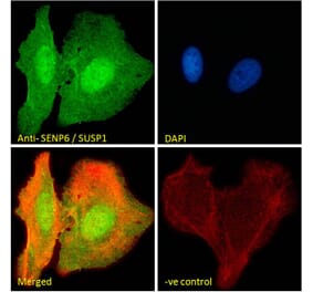 Immunofluorescence - Anti-SENP6 Antibody (A83351) - Antibodies.com