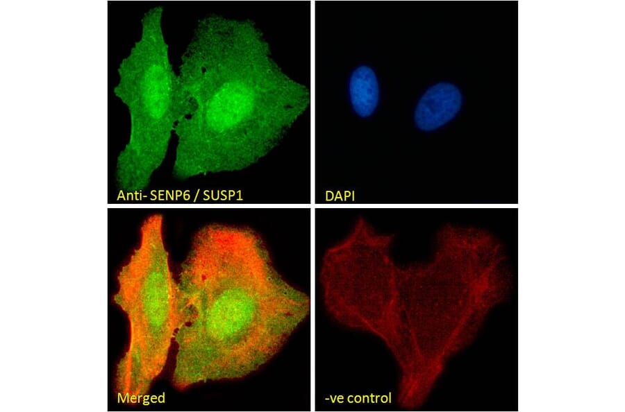 Immunofluorescence - Anti-SENP6 Antibody (A83351) - Antibodies.com