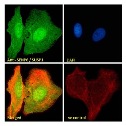 Immunofluorescence - Anti-SENP6 Antibody (A83351) - Antibodies.com