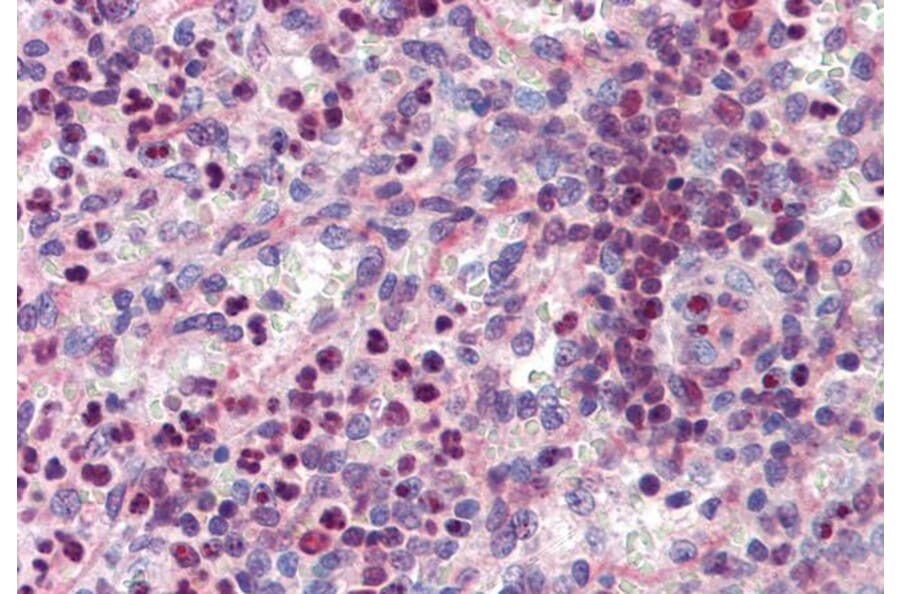 Immunohistochemistry - Anti-PU.1/Spi1 Antibody (A83352) - Antibodies.com