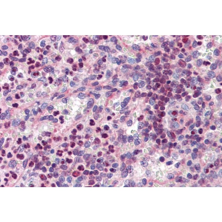 Immunohistochemistry - Anti-PU.1/Spi1 Antibody (A83352) - Antibodies.com