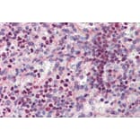 Immunohistochemistry - Anti-PU.1/Spi1 Antibody (A83352) - Antibodies.com