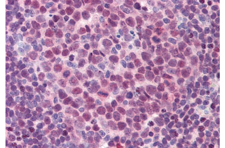 Immunohistochemistry - Anti-PU.1/Spi1 Antibody (A83352) - Antibodies.com