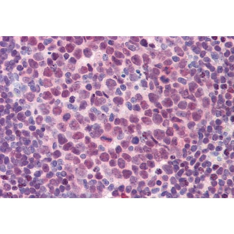 Immunohistochemistry - Anti-PU.1/Spi1 Antibody (A83352) - Antibodies.com